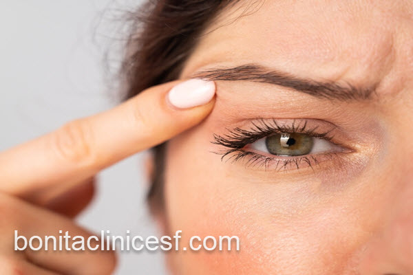 بهترین پزشک بلفاروپلاستی در اصفهان | کلینیک بنیتا اصفهان