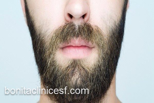 برترین کلینیک کاشت سبیل در اصفهان | کلینیک بنیتا اصفهان