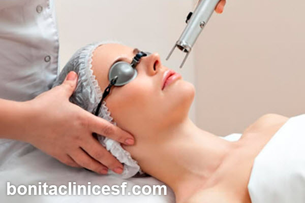 مزایای استفاده از لیزر CO2 فرکشنال