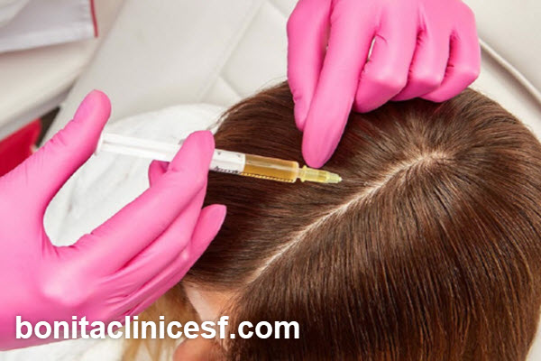 مزایای پی آر پی مو