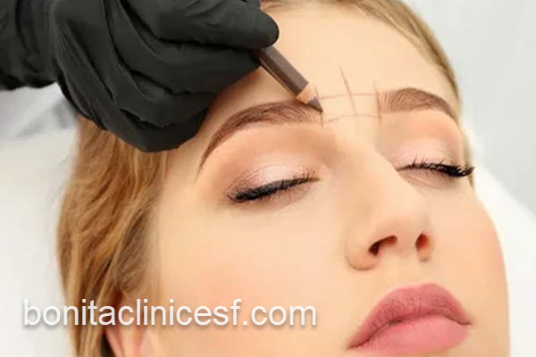 کاشت ابرو با مناسب ترین قیمت | کلینیک بنیتا اصفهان
