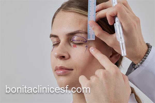 جراحی بلفاروپلاستی پلک توسط پزشک مجرب | کلینیک بنیتا اصفهان