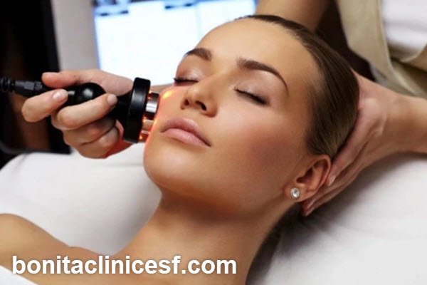 درمان جای جوش با لیزر CO2 فرکشنال در اصفهان