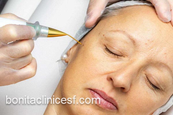کلینیک تخصصی خالبرداری در اصفهان | کلینیک بنیتا اصفهان