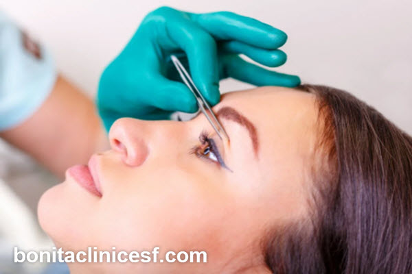 مزایای استفاده از لیزر در جراحی پلک