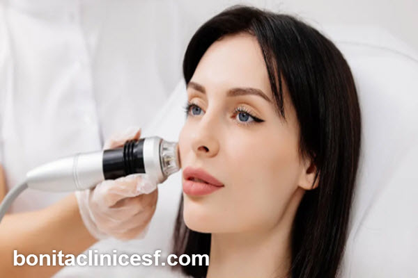 هزینه آر اف صورت در اصفهان چقدر است؟