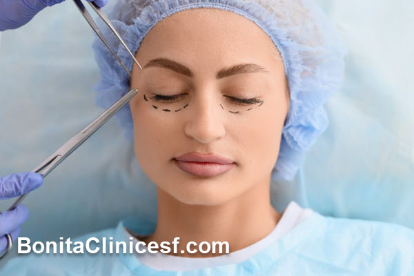 بلفاروپلاستی چیست و چه کاربردی دارد؟