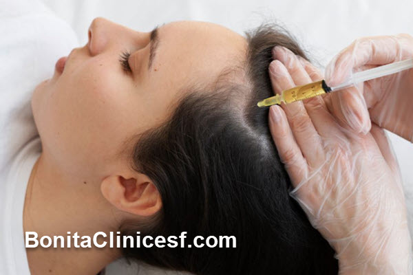 در چه شرایطی مزوتراپی مو انتخاب بهتری است؟