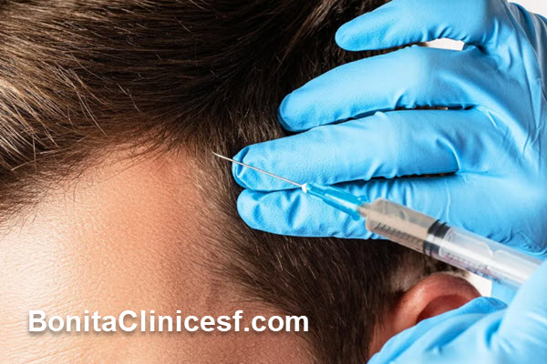 پی آر پی مو چیست و چگونه عمل میکند؟