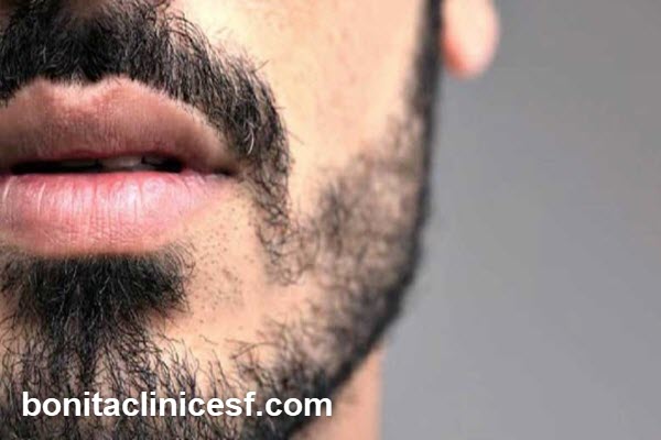 کاشت ریش و سبیل با بالاترین تراکم و جدیدترین روش
