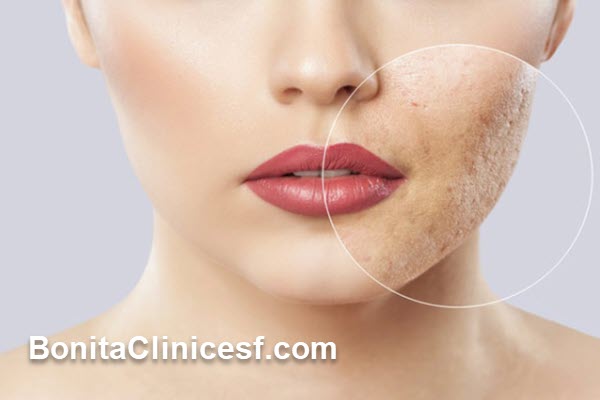 لک صورت چرا ایجاد میشود؟ | اصفهان